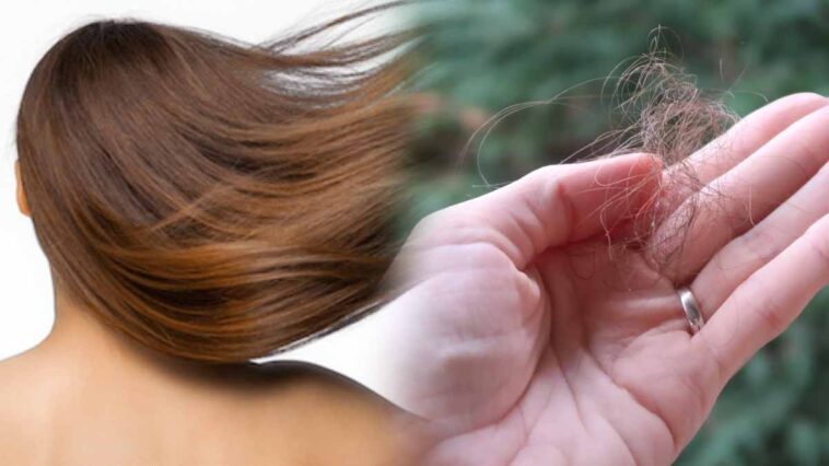 La chute de cheveux