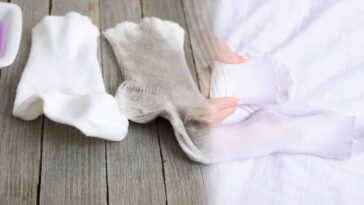 Chaussettes comme neuves : deux secrets de placard pour un blanchiment efficace!